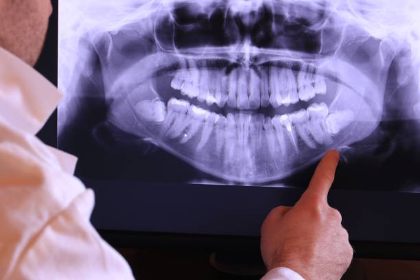 Best Emergency TMJ Treatment in Quitman, GA